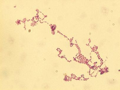 Ćwiczenie 5. Mikrobiologia jamy ustnej - Bakterie wywołujące stany zapalne i ropne w obrębie jamy ustnej rodzaj Staphylococcus, Streptococcus, Enterococcus).