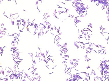 Neisseria, Treponema). Preparaty Corynebacterium diphtheriae i Corynebacterium pseudodiphtheriticum zabarwione metodą Neissera i metodą Grama (grec.