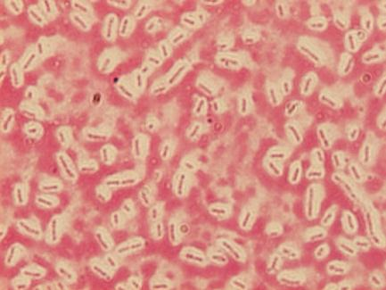 Ćwiczenie 1. Mikrobiologia ogólna - Budowa komórki bakteryjnej. Metody barwienia bakterii. Pożywki bakteryjne.