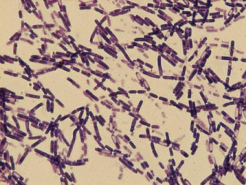 Ćwiczenie 1. Mikrobiologia ogólna - Budowa komórki bakteryjnej. Metody barwienia bakterii.