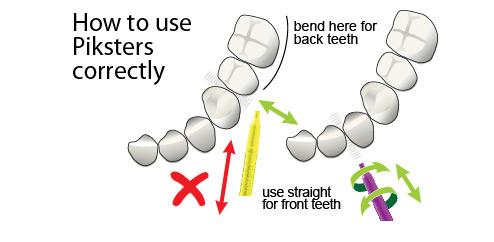 przestrzeń. Są jednak takie obszary w jamie ustnej, które dla lepszego i bezpieczniejszego czyszczenia, wymagają zgięcia rdzenia szczoteczki.