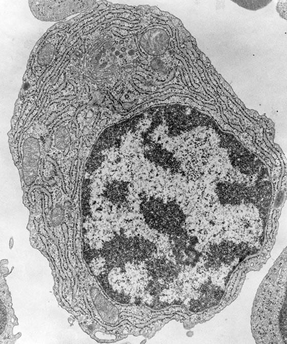 The chromatin Yin / Yang Heterochromatin