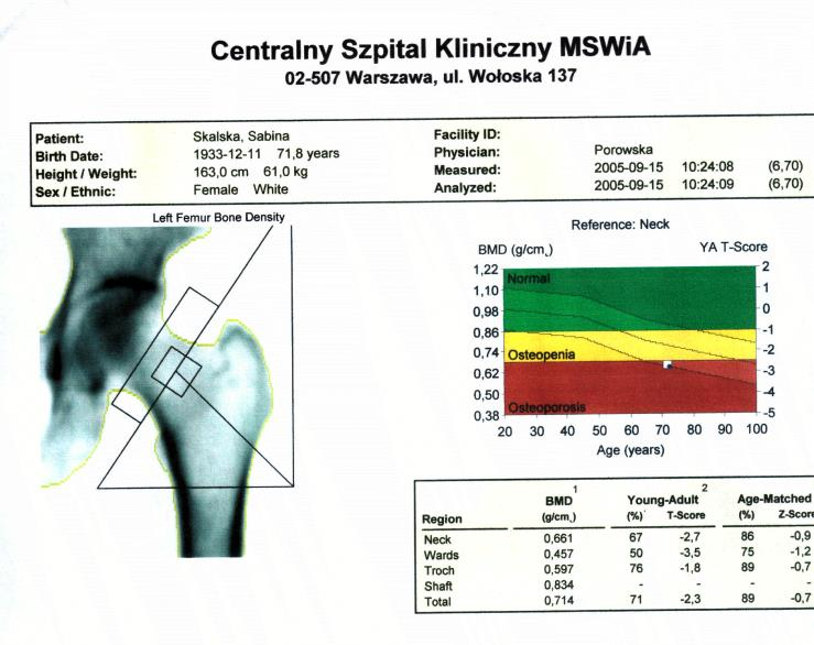 Bone mineral density in diabetes Type 1: Type 2: /=/( ) Thrailkill et