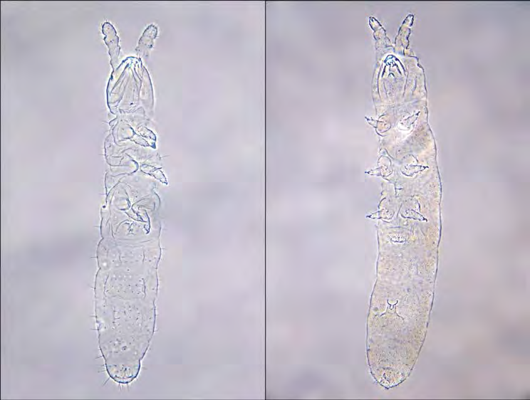 PSAMMOFILNE SKOCZOGONKI (COLLEMBOLA) NOWE DLA FAUNY POLSKI 9 Ryc. 3.