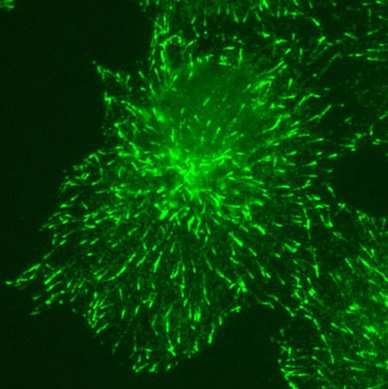 Zastosowanie immunocytochemii Analiza