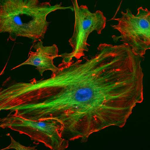 Ephitellial cell I mouse