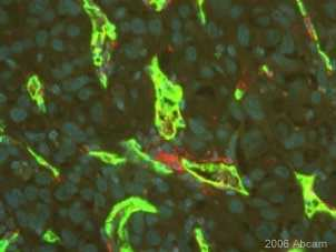 (Formalin/PFA-fixed paraffin-embedded sections) - Anti- CD34 antibody - Hematopoietic Stem Cell Marker (ab8158)