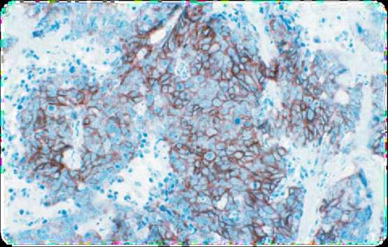 Ab8158 was incubated with the sample for 1 hour and then detected using an Alexa-Fluor 488 goat anti-rat