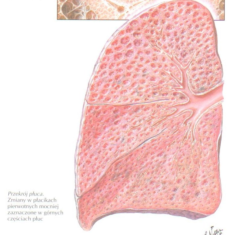 17 Obraz mikroskopowy płuc u