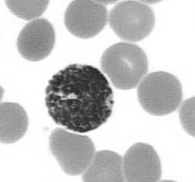 10 µm jądro segmentowe lub nie zasadochłonne ziarna swoiste