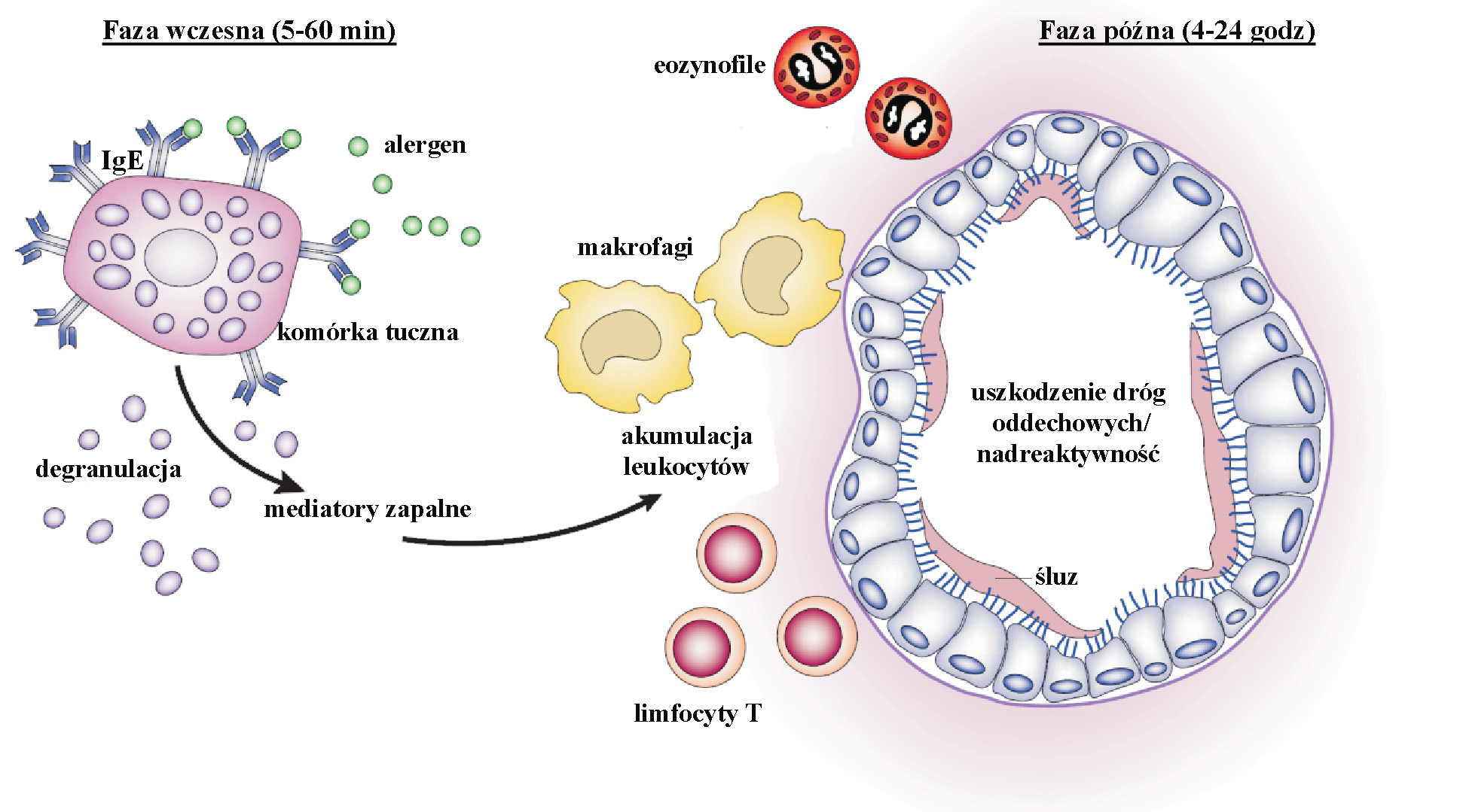Rola chemokin w astmie Faza wczesna (5-60 min) eozynofile Faza późna (4-24 godz) IgE alergen makrofagi komórka tuczna degranulacja mediatory zapalne akumulacja leukocytów uszkodzenie dróg