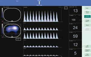 Anestezjologia Intensywna Terapia 2015; tom 47, nr 1, 80 84 Rycina 1.