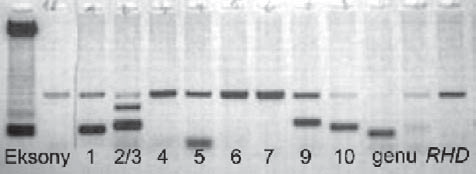 Monika Pelc-Kłopotowska i wsp., Fragmenty genu RHD u RhD ujemnych dawców krwi Tabela 1. Analiza molekularna DNA u dawców RhD ujemnych z wykrytymi fragmentami genu RHD Table 1.