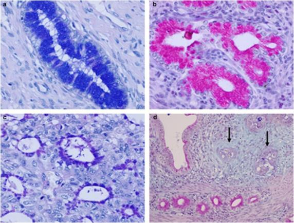 HISTOCHEMIA Dzięki metodom histochemicznym można precyzyjnie oznaczać w tkankach: białka, kwasy nukleinowe, enzymy, węglowodany Immunohistochemia jest to metoda wykrywania rozmaitych