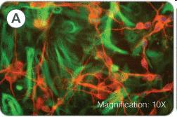 IMMUNOHISTOCHEMIA A.