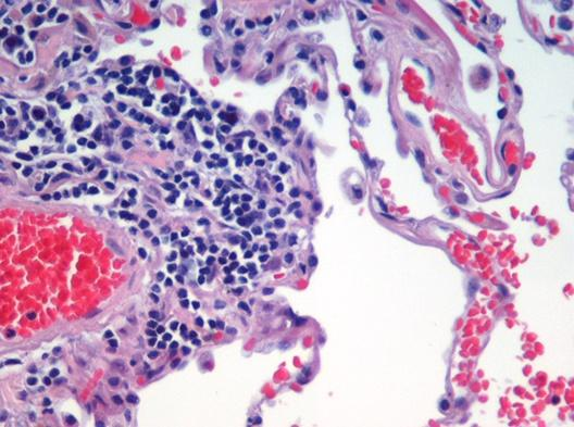 BARWIENIE H+E Rutynowa metoda barwienia preparatów w histologii (szybka, prosta, uniwersalna).