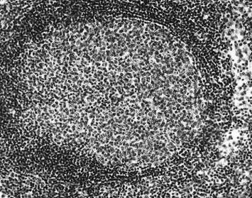 Mechanizmy obronne organizmu: Tkanka limfoidalna i układ limfatyczny Odporność wrodzona: bariery nabłonkowe komórki fagocytujące receptory rozpoznające wzorzec