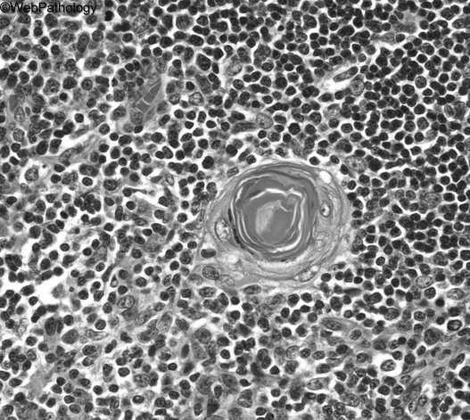 gwiaździste niedojrzałe limfocyty T i dendrytyczne prezentują limfocytom własne antygeny różnych tkanek wraz z antygenami MHC zasady selekcji: limfocyty, które nie rozpoznają