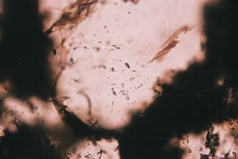 184 Miros³aw S³owakiewicz, Pawe³ Poprawa Fig. 2. Profil mikrofacji p³ycizn oolitowych ska³ wêglanowych dolomitu g³ównego w otworze wiertniczym Benice-3 (Miko³ajewski, 2007; S³owakiewicz i in.