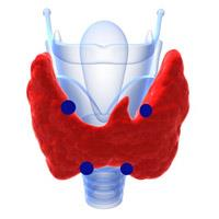 1α-hydroksylazy stężenia fosforu, wapnia,