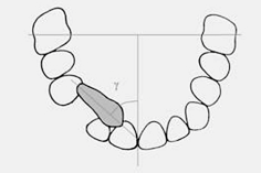 12,14): Bitewings of the palate are also useful for diagnosing the position of the impacted maxillary canine because they make it possible to determine both the impaction sector index and angle γ.