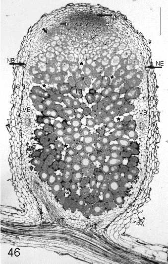 Pod merystem znajduje się strefa infekcji (SI), w której komórki pochodne merystemu są infekowane. Głębiej położona jest tkanka bakteroidalna (TB).