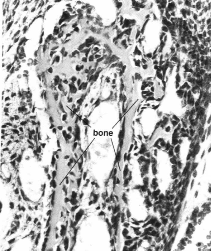 Kostnienie (osteogeneza) Kostnienie na podłożu mezenchymatycznym (kości