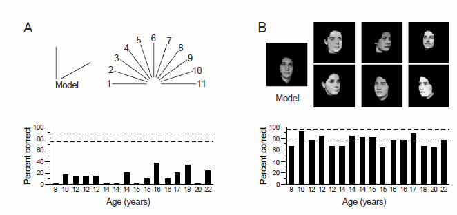 Przykład 4: rozpoznawanie twarzy przez pacjentów z WS Test Bentona na orientację (A)