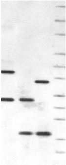 Variable number of tandem repeat (VNTR) Region VNTR 9 powtórzeń lokus allel