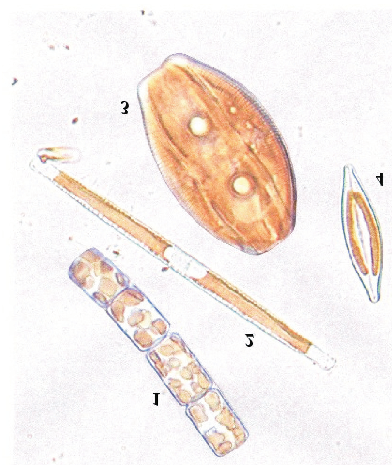 310 BARBARA RAKOWSKA Ryc. 3. Kszta³ty i barwy chloroplastów. 1 Melosira varians, 2 Nitzschia linearis, 3 Amphora ovalis, 4 Navicula gregaria gêszczenie od 20 do 200 milionów komórek w 1 litrze wody.