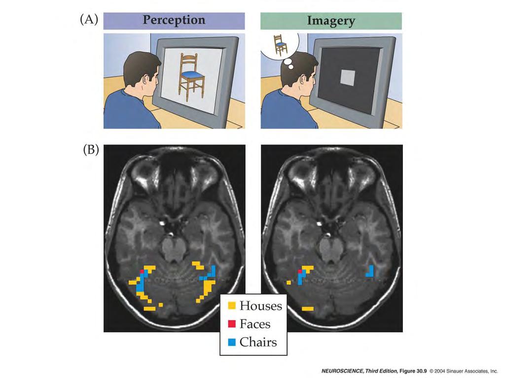 30.9 Reactivation of visual cortex