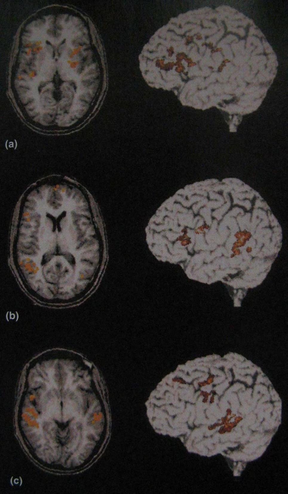 Bierne słuchanie Język angażuje obie półkule (nie tylko dominującą) Badania fmri funkcji językowych