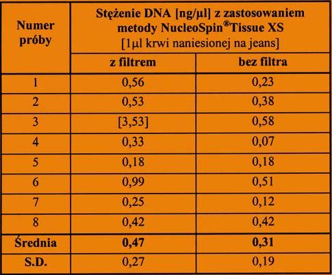 Tabela 5 Stê enie DNA [ng/μl] uzyskane w zale noœci od zastosowanego wariantu oddzielania lizatu od pod³o a przy izolacji DNA metod¹ NucleoSpin Tissue XS z materia³u stanowi¹cego 1 μl krwi