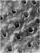 wysokość/szerokość 4 x 8 µm długość równa grubości szkliwa (ok.