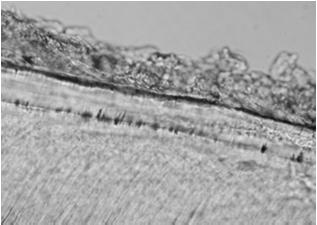 bogatokomórkowa tkanka łączna galaretowata warstwa odontoblastów