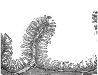 śluzowe (podobne do komórki nabłonka powierzchniowego) - komórki śluzowe (identyczne jak