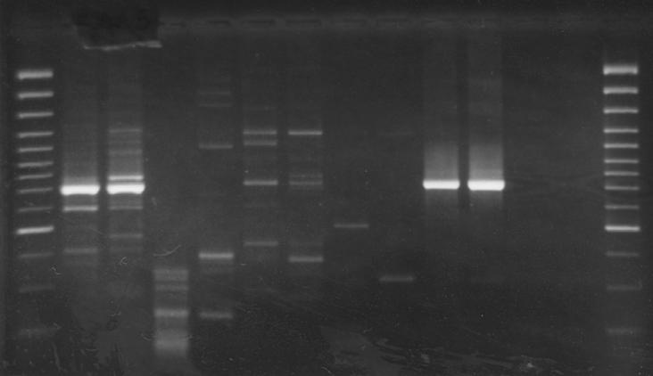 WYNIKI Analiza tolerancyjności na glin pojedynczych siewek zestawu linii addycyjnych pszenicy Chinese Spring z addycjami chromosomów żyta Blanco metodą testu laboratoryjnego wykazała, że reakcja