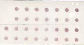 The results of hybridization of DNA probes prepared from fragments 627 bp (A), 990 bp (B), specific for tolerant form