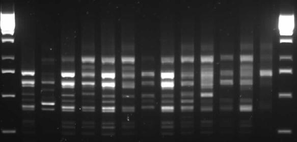 Nr 3 Feno- i genotypowa charakterystyka C.albicans 237 M 1 2 3 4 5 6 7 8 9 10 11 12 13 M M 14 15 16 1718192021 222324 25 262728 2930 31 M Ryc. 2 Typowanie genetyczne szczepów C.