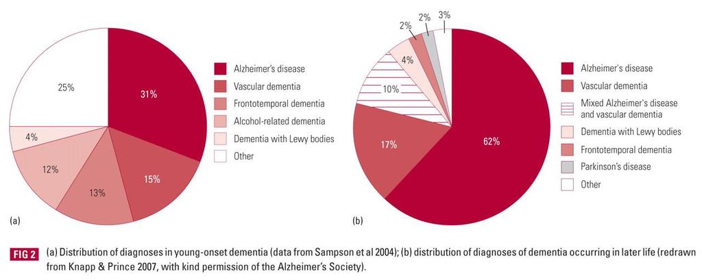 Choroba Alzheimera o