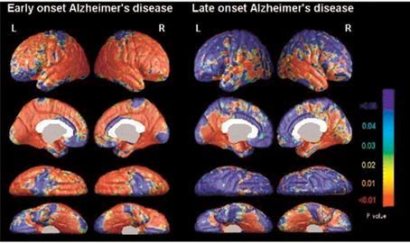 anterior cingulate and orbital cortex.