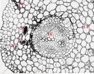 infekcji CP- parenchyma korowa GC-