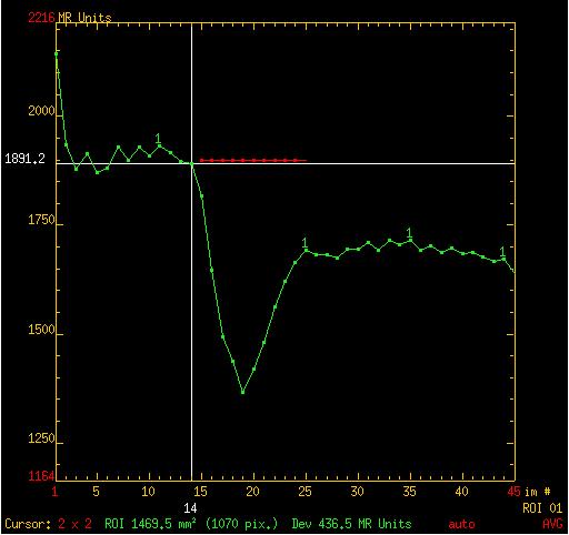 Volume relative Percentage of Signal Recovery