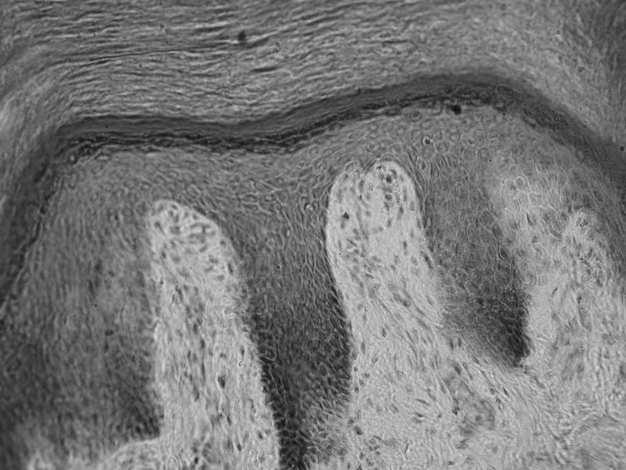 warstwie podstawnej w cytoplazmie drobne ziarenka