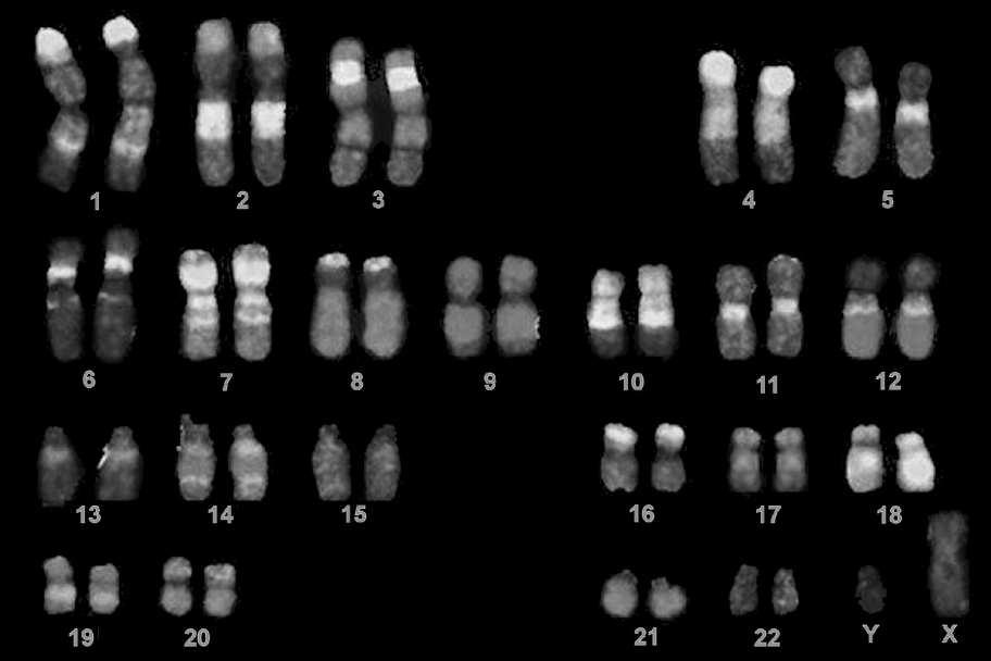 wykrywa odcinki DNA lub RNA o określonej sekwencji nukleotydów Sonda: odcinek DNA