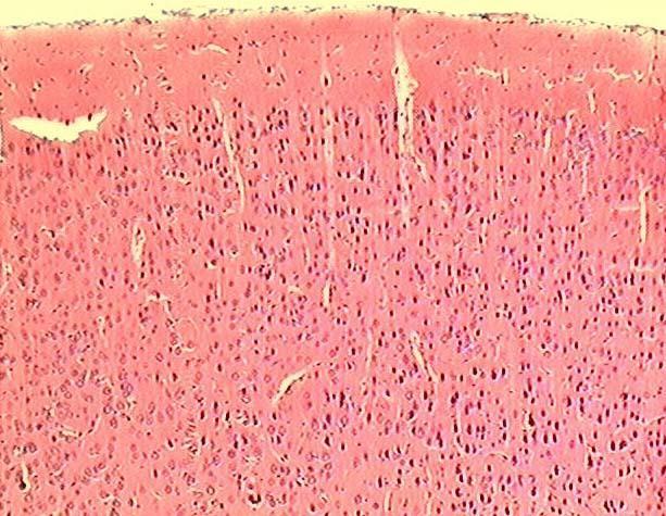 Kora mózgu 1. Warstwa drobinowa Wrzecionowate neurony poziome Aksony i dendryty równolegle do kory 2.