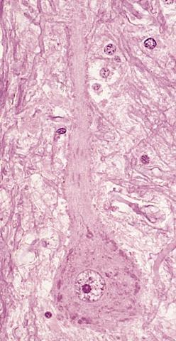 Ciało neuronu (perikarion) Neuron dwubiegunowy Perikarion Akson Zakończenie aksonu Dłg do 1,5 m Akson