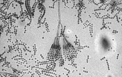 100x / macroculture on the Czapek-Dox agar x100 B preparat