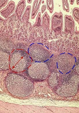 Dyfuzyjna tkanka limfoidalna Ze względu na miejsce występowania komórek limfoidalnych zwana jest tkanką limfatyczną związaną z błoną śluzową (MALT) MALT Mucosa-associated lymphoid tissue BALT