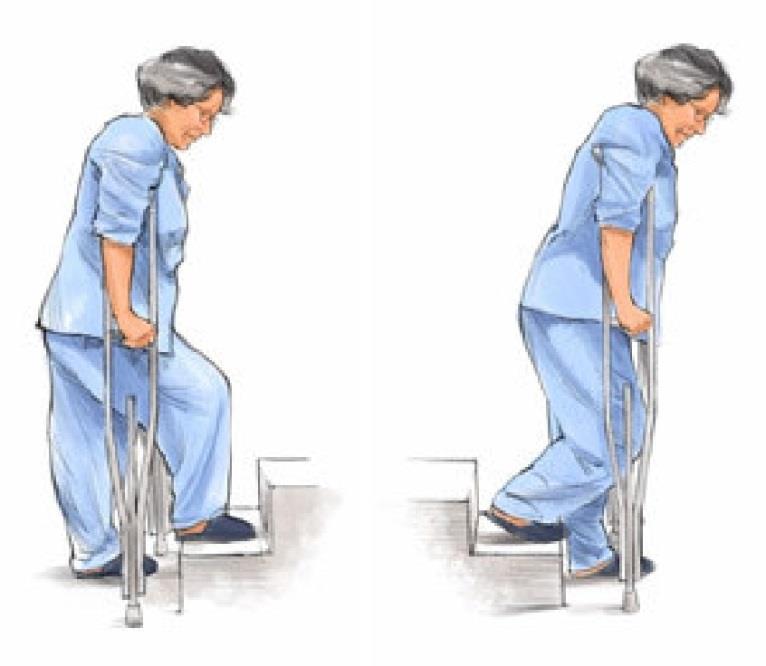Podczas fazy przeniesienia nogi zdrowej ciężar ciała pacjenta spoczywa na przyrządzie